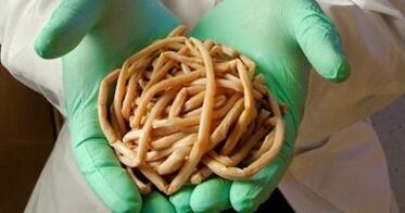 az emberi testből kivont paraziták