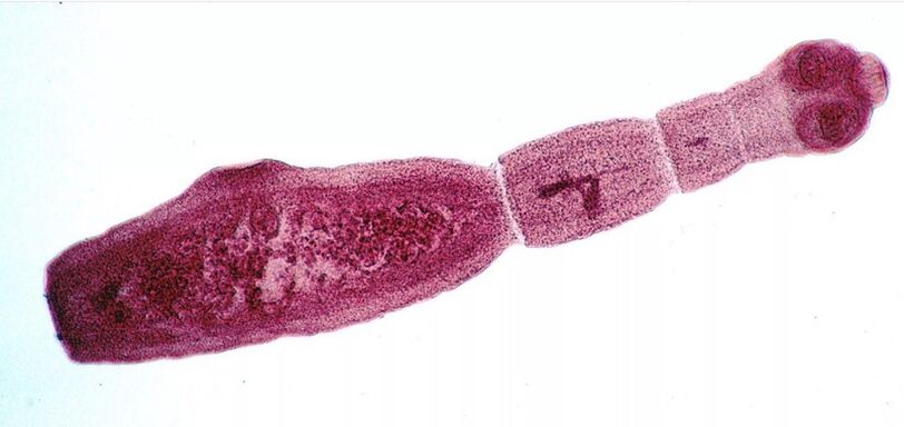 Az Echinococcus az ember számára az egyik legveszélyesebb parazita