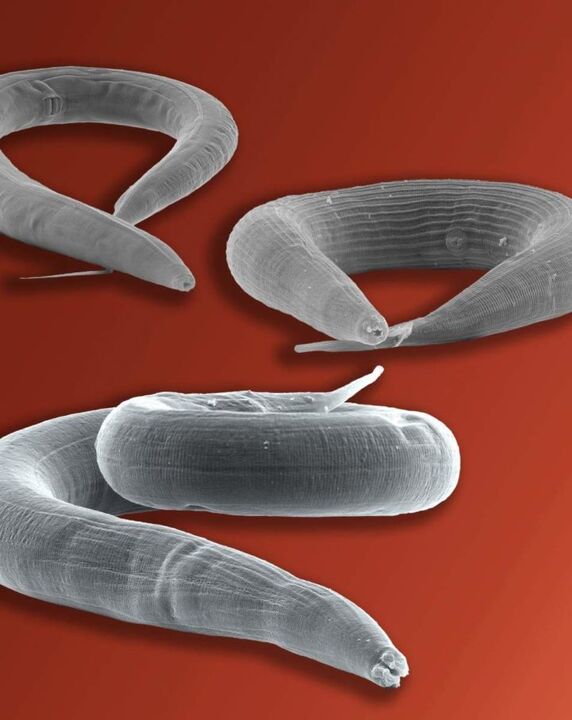 a belekben élő pinworm parazita