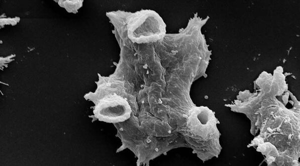 A Negleria fowlera egy emberi életre veszélyes protozoon parazita. 