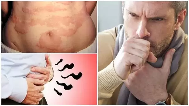 Az allergia, a köhögés és a puffadás a férgek által okozott károsodás jelei a szervezetben