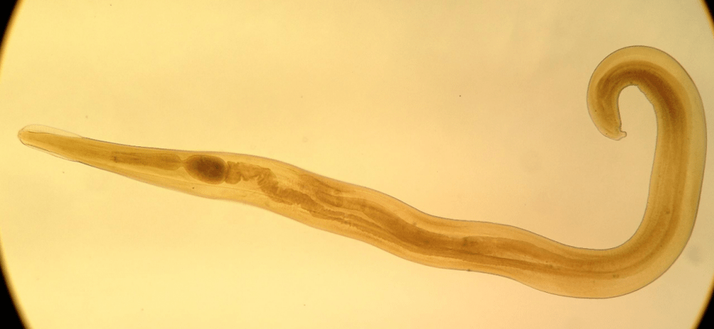 A pinworm gyakori parazita a gyermekek körében. 